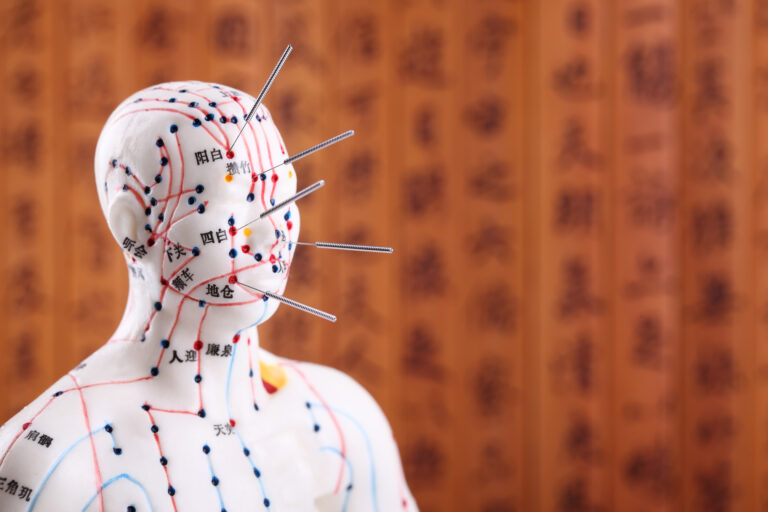 Eastern or Asian acupuncture Medical Treatment.