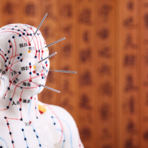 Eastern or Asian acupuncture Medical Treatment.