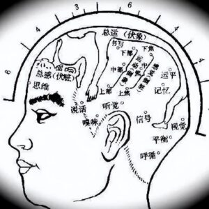 微象针灸 - 方氏头皮针